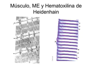 Músculo, ME y Hematoxilina de 
Heidenhain 
 