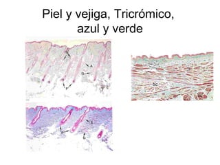Piel y vejiga, Tricrómico, 
azul y verde 
 