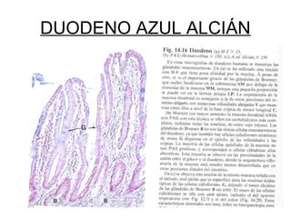 DUODENO AZUL ALCIÁN 
 