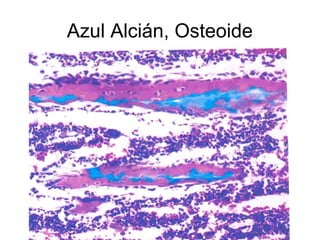 Azul Alcián, Osteoide 
 