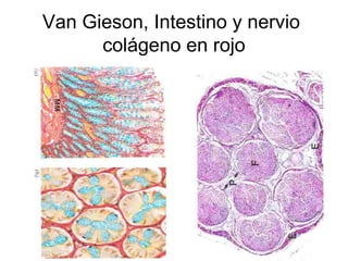 Van Gieson, Intestino y nervio
colágeno en rojo