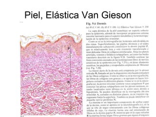 Piel, Elástica Van Gieson 
 