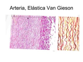 Arteria, Elástica Van Gieson 
 