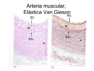 Arteria muscular, 
Elástica Van Gieson 
 