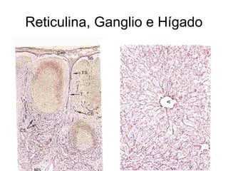 Reticulina, Ganglio e Hígado 
 