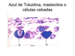 Azul de Toluidina, mastocitos o 
células cebadas 
 