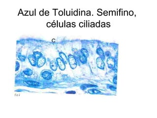 Azul de Toluidina. Semifino,
células ciliadas