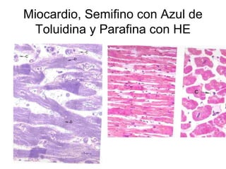 Miocardio, Semifino con Azul de 
Toluidina y Parafina con HE 
 