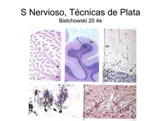 S Nervioso, Técnicas de Plata 
Bielchowski 20 4e 
 