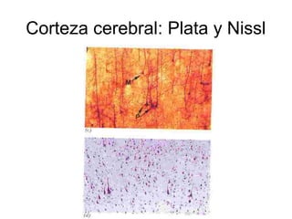 Corteza cerebral: Plata y Nissl 
 