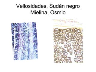 Vellosidades, Sudán negro 
Mielina, Osmio 
 