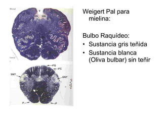 Weigert Pal para 
mielina: 
Bulbo Raquídeo: 
• Sustancia gris teñida 
• Sustancia blanca 
(Oliva bulbar) sin teñir 
 
