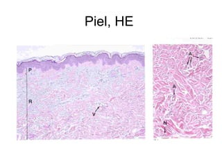 Piel, HE 
 