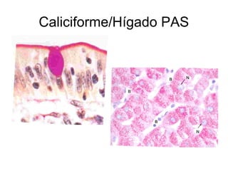 Caliciforme/Hígado PAS 
 