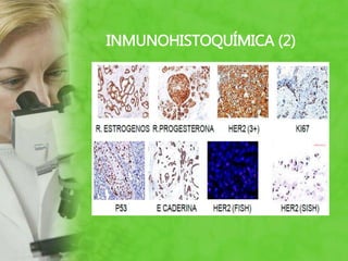 INMUNOHISTOQUÍMICA (2)
 