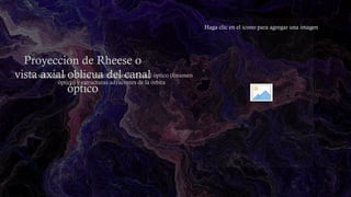 Técnicas Radiográficas Avanzadas para Proyecciones Craneales y Óseas | PPTX
