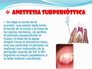  Anestesia Subperióstica
•- Se elige el punto de la
punción, que estará dado entre
el borde de la encía y la línea de
los ápices dentarios, se perfora
el periostio perpendicular al
hueso; el bisel de la aguja
dirigido hacia la estructura ósea,
una vez perforado el periostio se
realizará una inclinación de la
jeringuilla carpule de 45º a 90º,
logrando el mayor paralelismo a
la tabla externa mandibular.
 