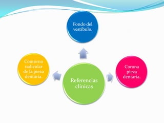 Referencias
clínicas
Fondo del
vestíbulo.
Corona
pieza
dentaria.
Contorno
radicular
de la pieza
dentaria.
 