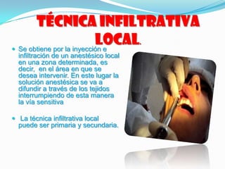  Se obtiene por la inyección e
infiltración de un anestésico local
en una zona determinada, es
decir, en el área en que se
desea intervenir. En este lugar la
solución anestésica se va a
difundir a través de los tejidos
interrumpiendo de esta manera
la vía sensitiva
 La técnica infiltrativa local
puede ser primaria y secundaria.
Técnica infiltrativa
local.
 