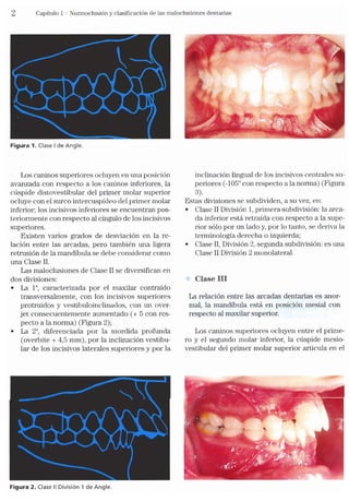 Tecnicas Ortodonticas