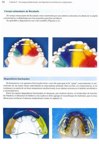 Tecnicas Ortodonticas