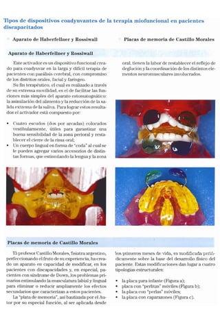 Tecnicas Ortodonticas