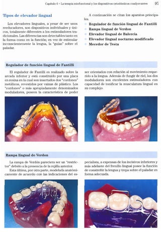 Tecnicas Ortodonticas