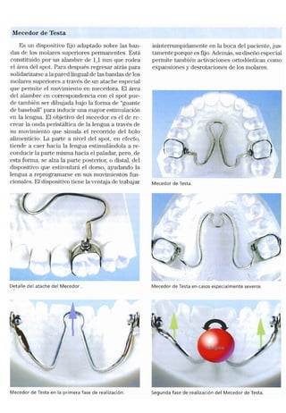 Tecnicas Ortodonticas