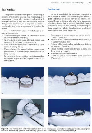 Tecnicas Ortodonticas