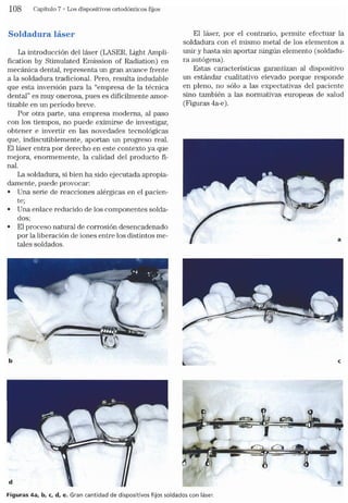 Tecnicas Ortodonticas