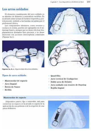 Tecnicas Ortodonticas