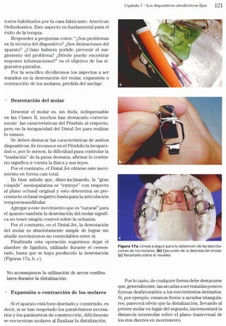Tecnicas Ortodonticas
