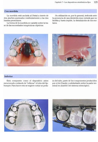 Tecnicas Ortodonticas