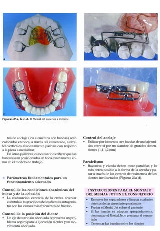 Tecnicas Ortodonticas