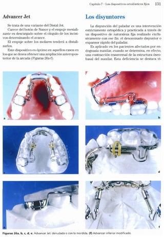 Tecnicas Ortodonticas