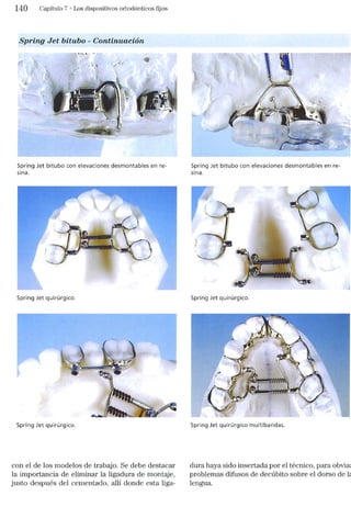 Tecnicas Ortodonticas