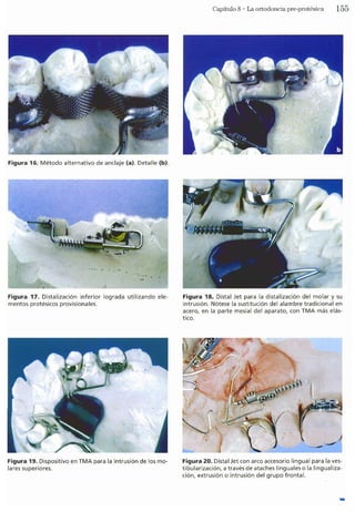 Tecnicas Ortodonticas