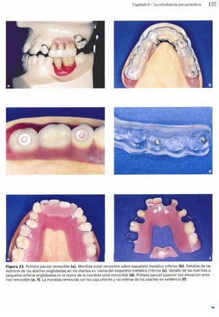 Tecnicas Ortodonticas