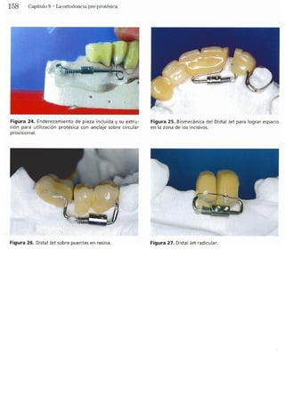 Tecnicas Ortodonticas