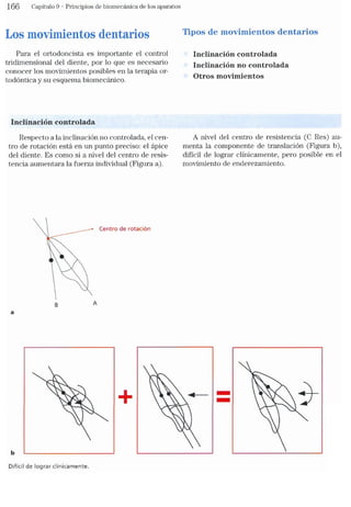 Tecnicas Ortodonticas