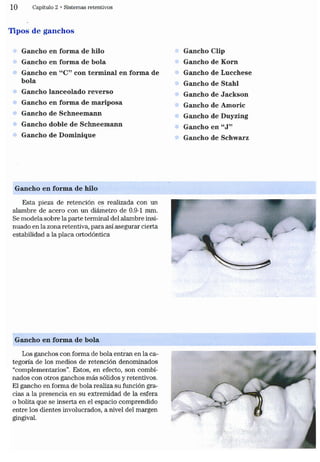 Tecnicas Ortodonticas