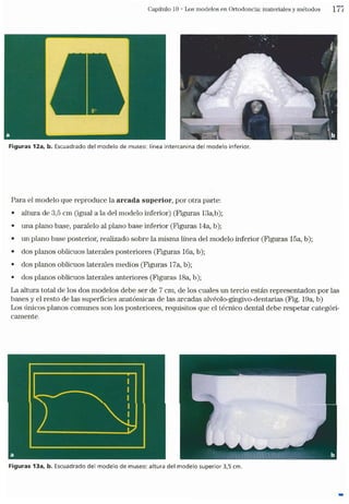 Tecnicas Ortodonticas