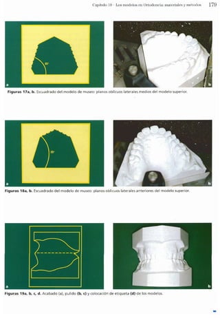 Tecnicas Ortodonticas