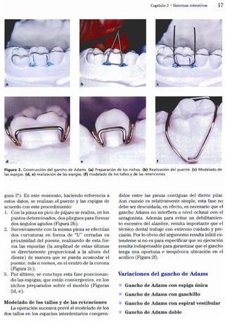 Tecnicas Ortodonticas