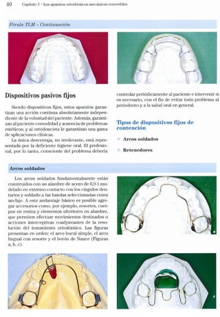 Tecnicas Ortodonticas