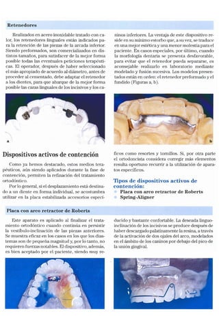 Tecnicas Ortodonticas