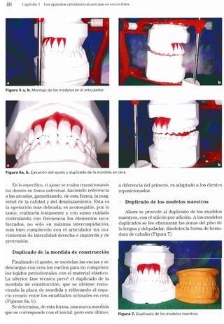 Tecnicas Ortodonticas