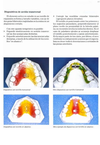 Tecnicas Ortodonticas