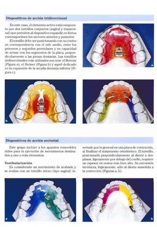 Tecnicas Ortodonticas