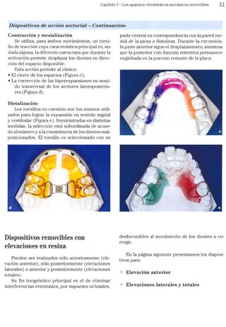 Tecnicas Ortodonticas